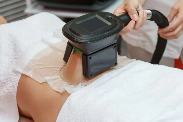Image of person having fat freezing treatment to help weight gain Brentwood