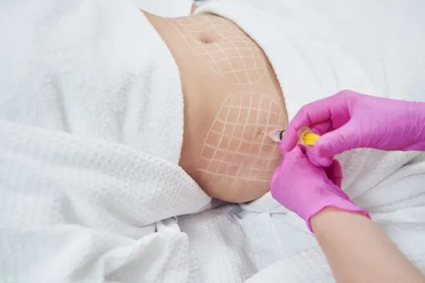 image of fat dissolving injections on love handles to help combat weight gain Brentwood