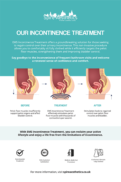 image to show how EMS treatment works for female urinary incontinence Brentwood