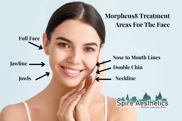Where can Morpheus8 Treatment Brentwood be done on the body?