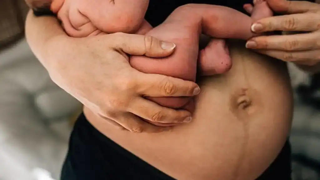 Why Is My Stomach Still Big After Pregnancy Brentwood?