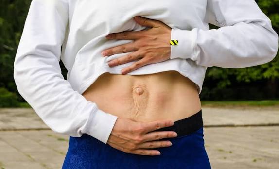 When Could Diastasis Recti Be the Missing Piece of the Puzzle Brentwood?